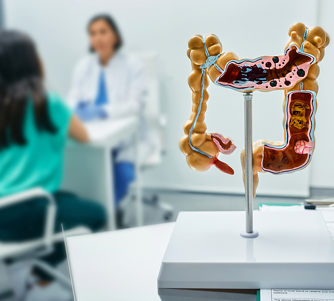 Modello medico di intestino in uno studio medico – screening del cancro colorettale senza franchigia dal luglio 2025 in Svizzera