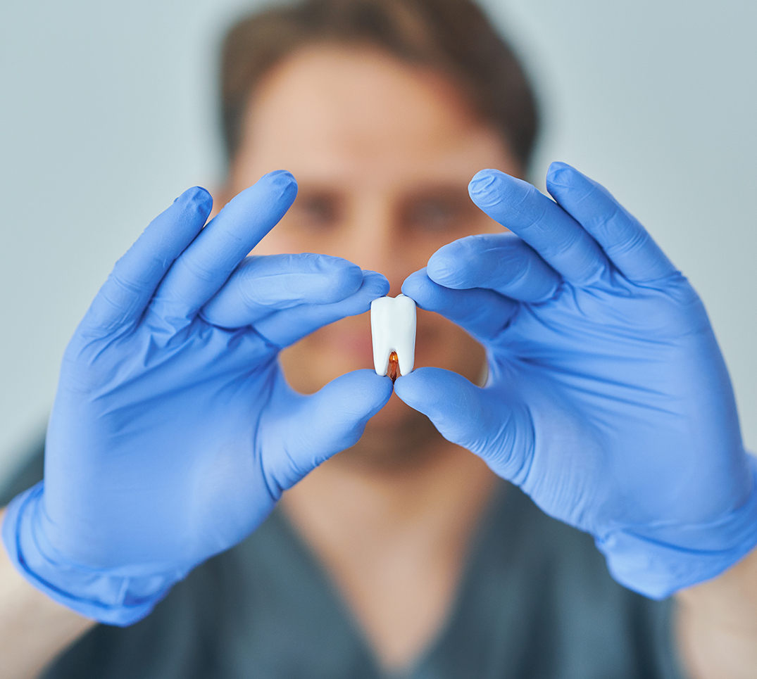 Dent expulsée – conserver correctement, agir rapidement Une dent arrachée est tenue avec des gants. Une conservation adéquate dans du lait ou une boîte de sauvetage dentaire peut sauver la dent.